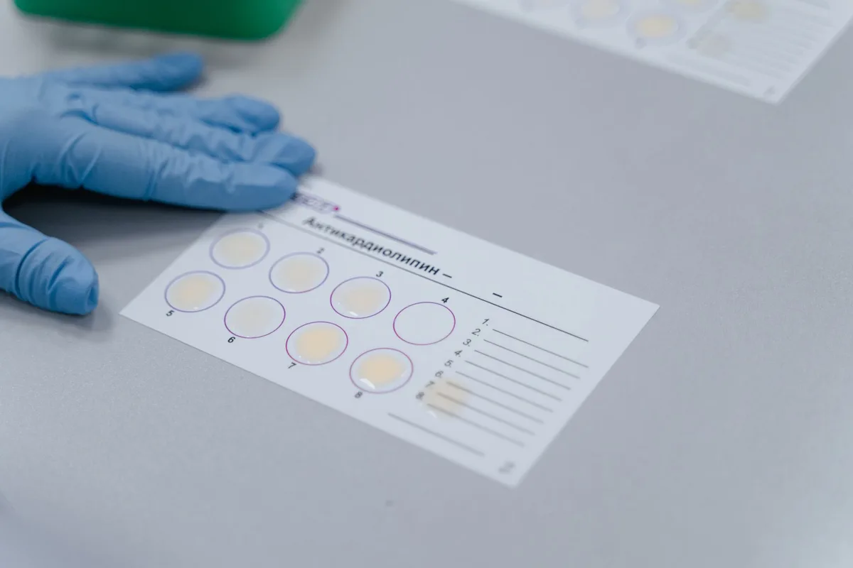 Résultats de test sanguin montrant les valeurs de cholestérol et de lipides
