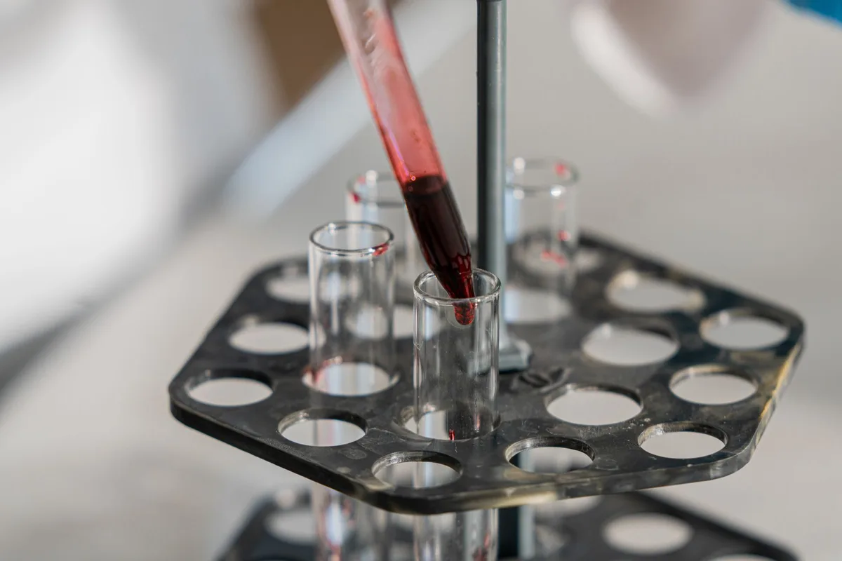 Analyse de groupe sanguin en laboratoire avec tube de prélèvement sanguin