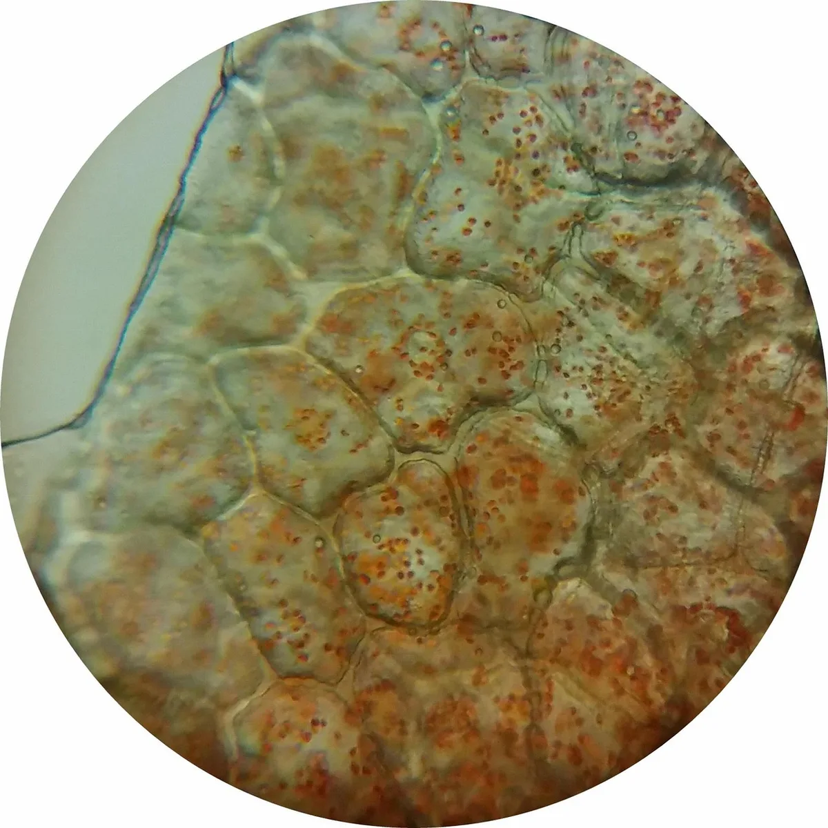 Micrographie illustrant l'apoptose cellulaire