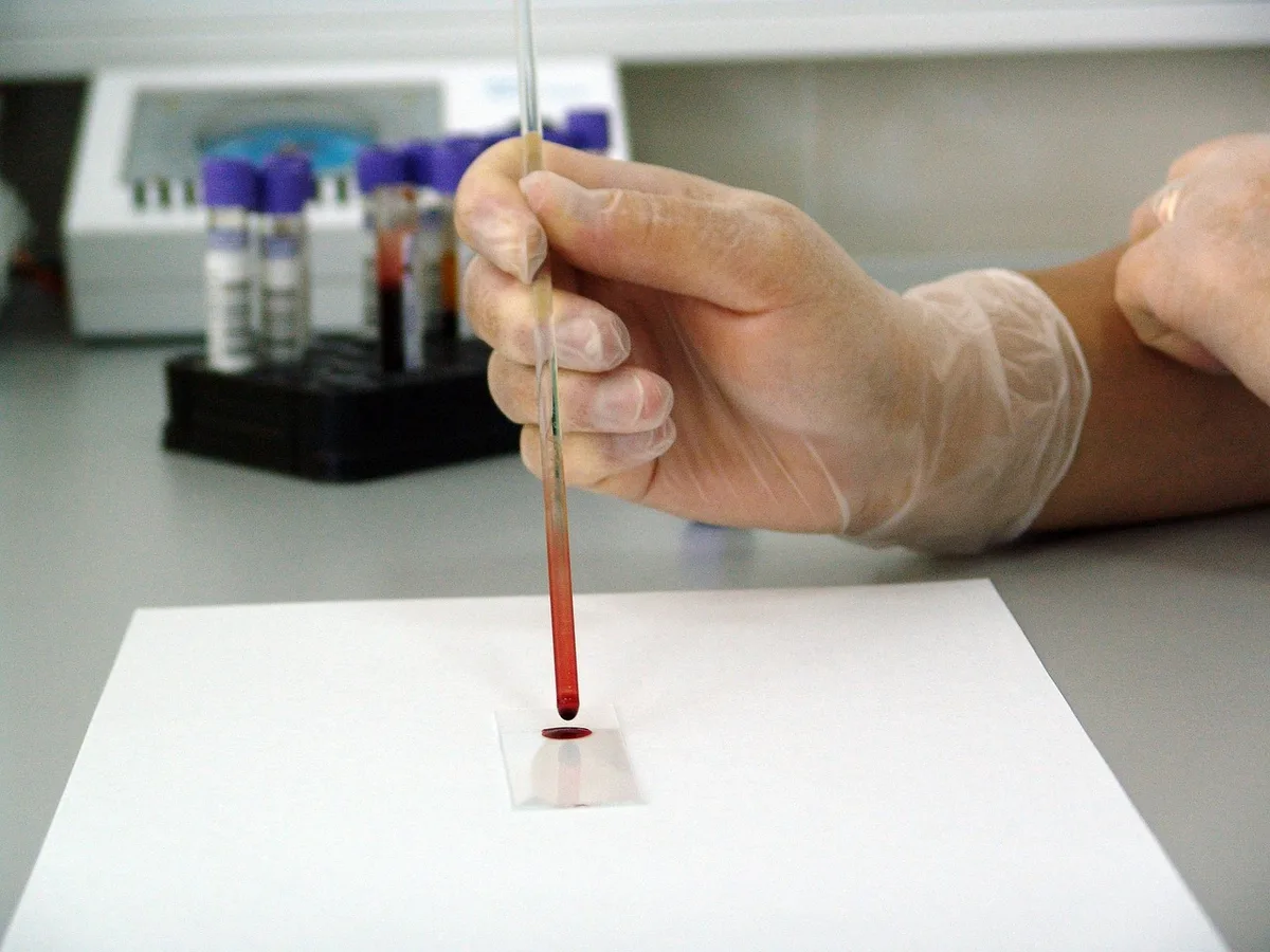 Flacon d'échantillon d'urine et bandelette de test sur un plan de travail